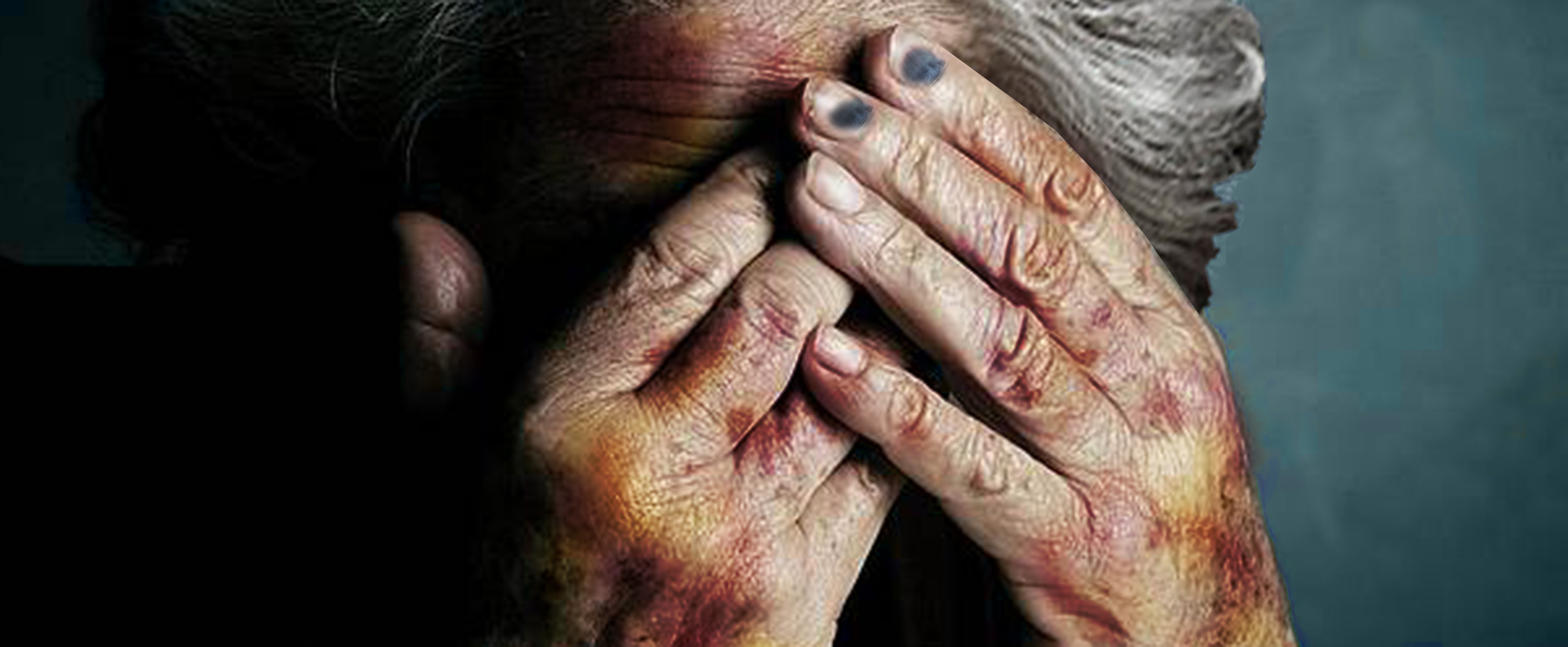 Polk County's Top Nursing Home Sexual Abuse Lawyer, Dean Burnetti, Discusses Nursing Home Sexual Abuse