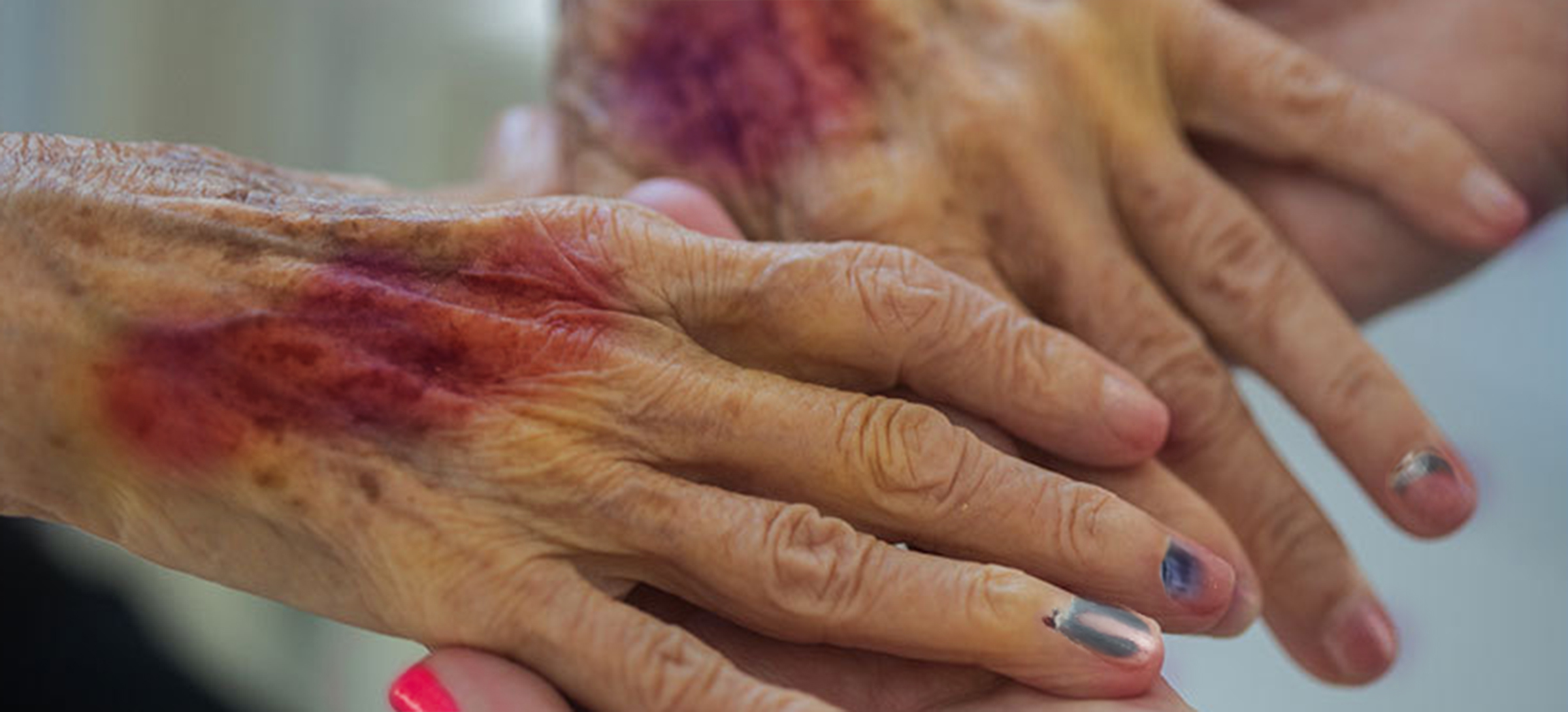 Dean Burnetti Answers Frequently Asked Medical Malpractice Questions